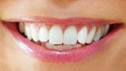 Белые зубы после отбеливания