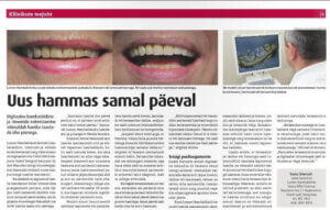 Lumen_Dental_Clinic_article_One_day_dentistry